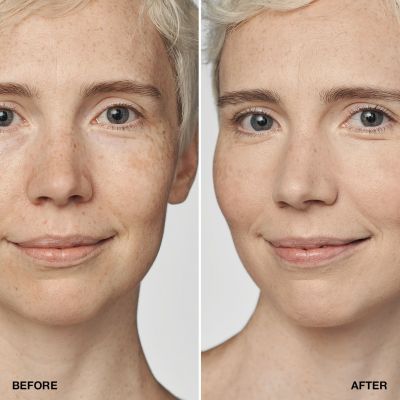 CLINIQUE Even Better Clinical™ Serum Foundation SPF 20 Tonālais krēms