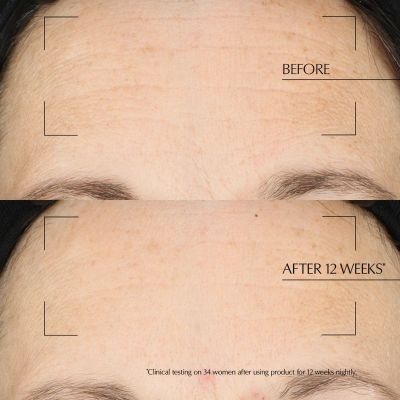 ESTÉE LAUDER Advanced Night Repair Overnight Treatment Atjaunojošs nakts krēms sejas krēms