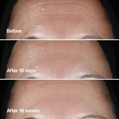 CLINIQUE Smart Clinical Repair Wrinkle Correcting Serum Nostiprinošs sejas serums