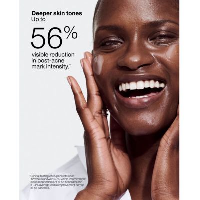 CLINIQUE Even Better Clinical™ Dark Spot Clearing Serum Sejas serums