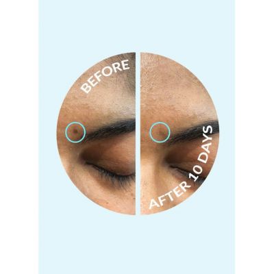 TALIKA PIGMENT CONTROL PATCH Izgaismojoša sejas maska
